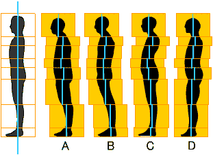 歪んだ姿勢のパターン